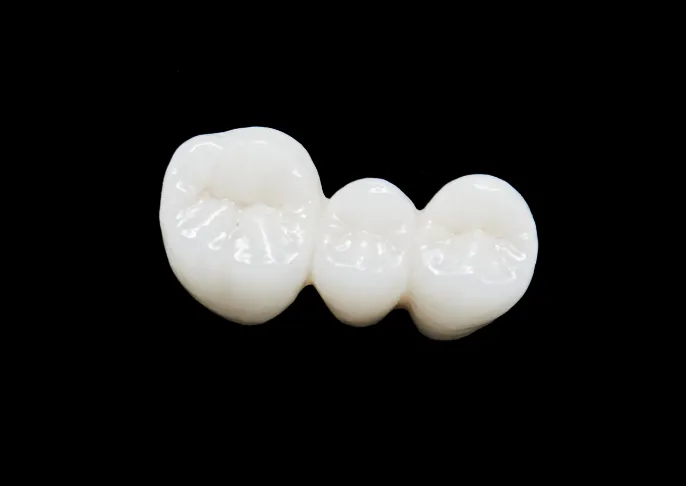セラミック治療で白く美しい歯に